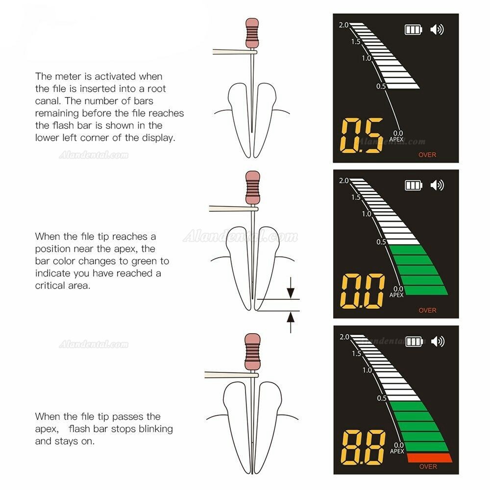 Westcode Dental Endodontic Mini Apex Locator